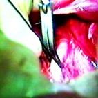 جراحی در جنگ و حوادث