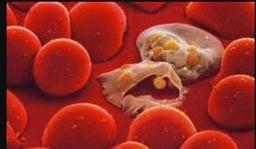 سپتی سمی چیست ؟