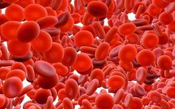 پلی سیتمی چیست ؟