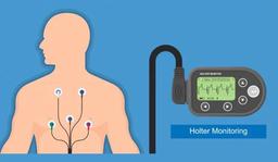 هولتر یا هالتر قلب چیست؟