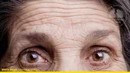 چگونه چین و چروک پیشانی را از بین ببریم ؟