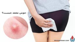 جوش مقعدی با عکس و [درمان خانگی و جراحی]