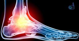 علت درد کف پا در سالمندان