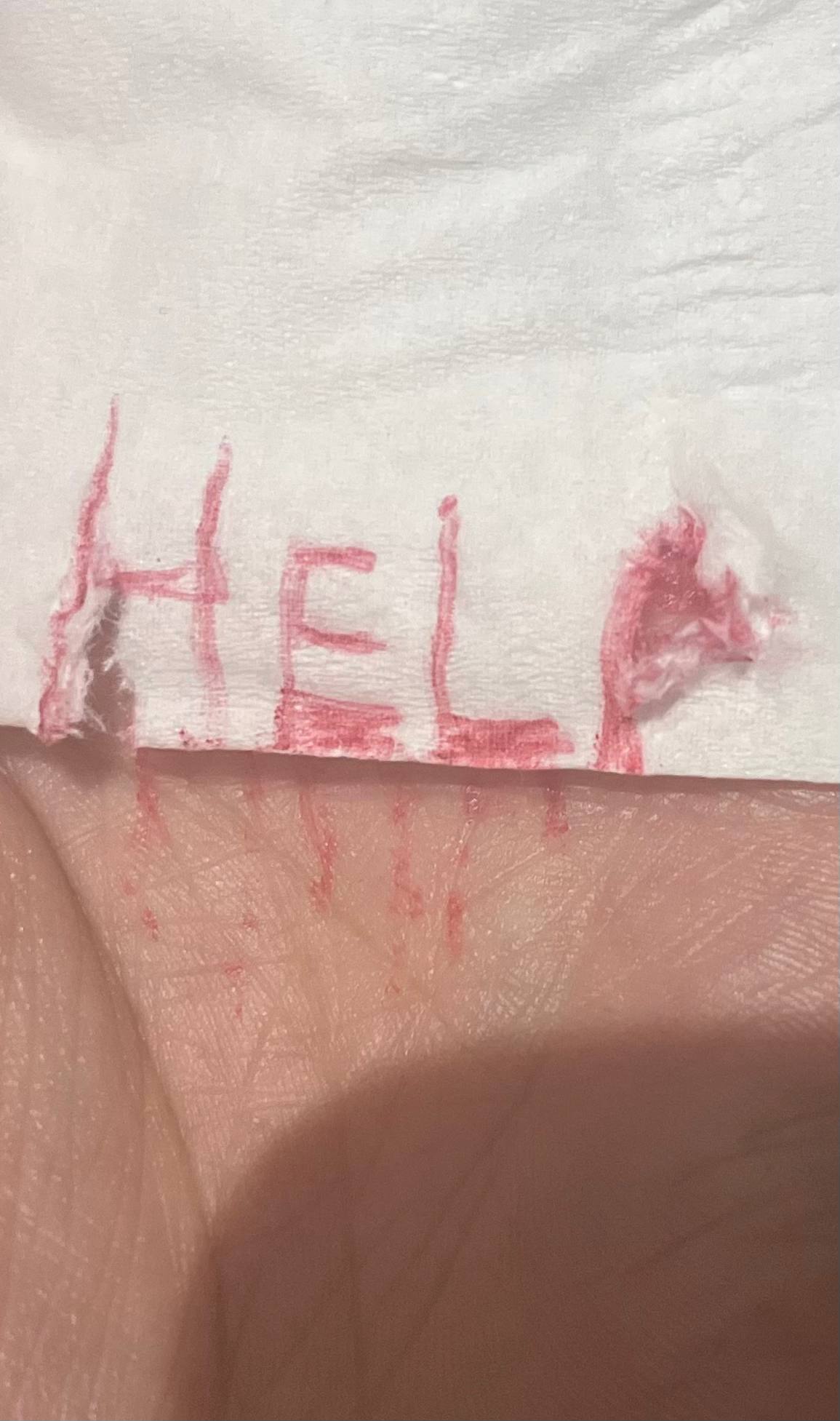 نمای نزدیک «کمک خونی»