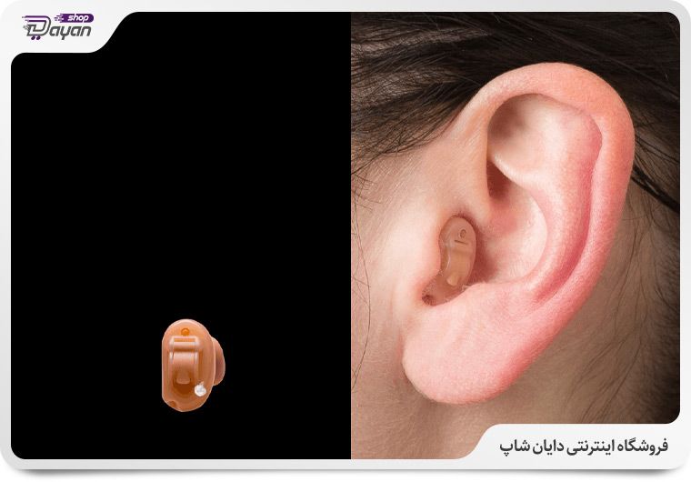 نحوه قرارگیری در گوش
