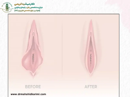 یک بار برای همیشه با این موضوع کنار بیایید!