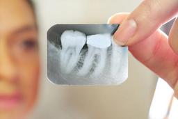 جراحی ریشه دندان عفونی