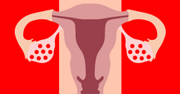 علائم بالینی تنبلی تخمدان