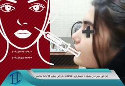 جراحی زیبایی بینی در مشهد | معرفی برترین پزشکان زیبایی مشهد