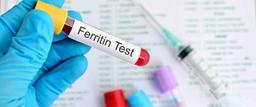 فریتین بالا در آزمایش خون
