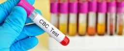 آزمایش CBC چیست و در چه مواردی استفاده می‌شود؟