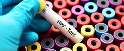 آزمایش HPV چگونه انجام می‌شود؟