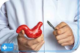 عمل اسلیو معده چیست؟