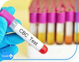 سیر تا پیاز آزمایش CBC