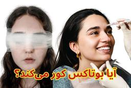 بوتاکس و خطر کوری: واقعیت یا افسانه؟ یک بررسی جامع