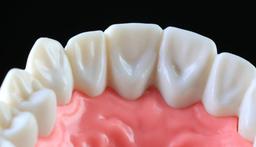 بهترین نوع کامپوزیت دندان کدام است