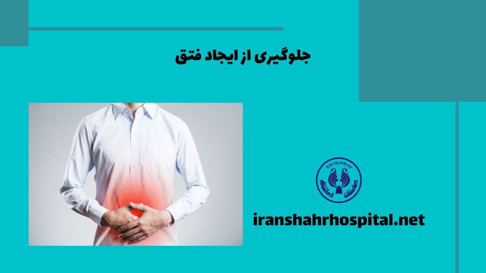 جلوگیری از ایجاد فتق