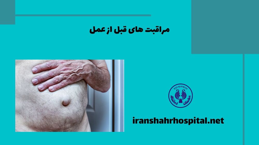 مراقبت های قبل از عمل