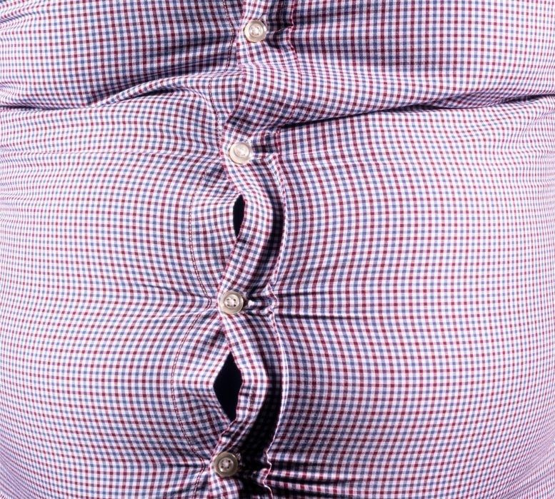 شکل ۱. چاقی در افراد مبتلا به دیابت نوع ۱