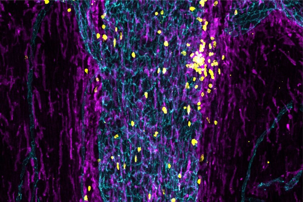 درب پشتی‌ای که به سیستم ایمنی اجازه می‌دهد مغز را پایش کند