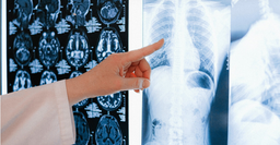 ارائه پایگاه داده تصویربرداری هوش مصنوعی برای تشخیص کرونا به بیمارستان‌های انگلستان