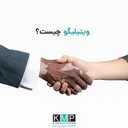 ویتیلیگو چیست