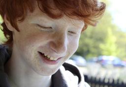 هر آنچه باید درمورد جوش پوستی در کودکان بدانید