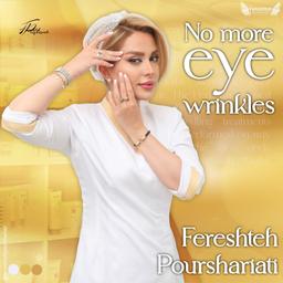 رفع خطوط پنجه کلاغی