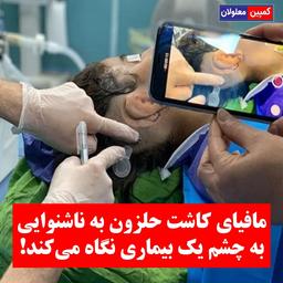 جولان مافیای کاشت حلزون در کشور / آمار دقیقی از تعداد ناشنوایان نداریم!