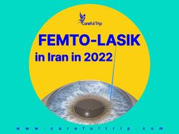 Femto LASIK in Iran