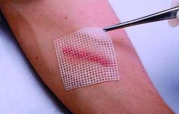 بهبود زخم ها با تولید زخم پوش های آنتی باکتریال