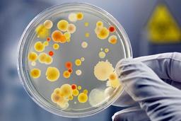 ضرورت مصرف پروبیوتیک در طیور گوشتی