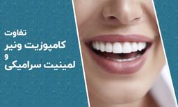 تفاوت لمینیت سرامیکی و کامپوزیت ونیر چیست؟
