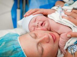 زایمان سزارین اختیاری به جنین آسیب می رساند؟