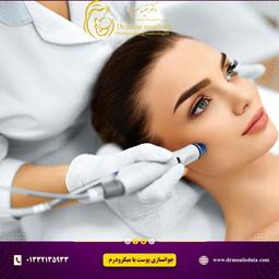 معجزه ایی به نام میکرودرم برای جوانسازی پوست