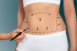 لیپوساکشن چیست؟