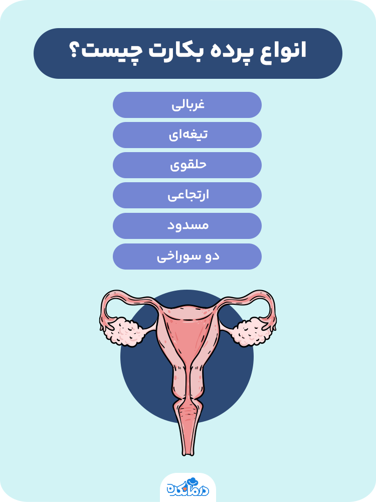اینفوگرافیکی که انواع پرده بکارت را نشان می‌دهد. 