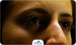 زردی پوست و کم خونی چه ارتباطی با هم دارند؟