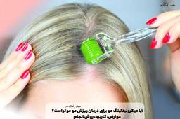 میکرونیدلینگ مو چیست؟ آیا میکرونیدلینگ مو برای درمان ریزش مو موثر است؟ عوارض، کاربرد، روش انجام