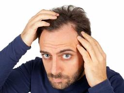 درمان شوره سر در مدیران = رشد کسب و کار