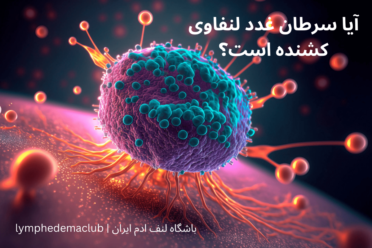 سرطان غدد لنفاوی
