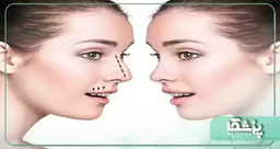 آمادگی لازم برای عمل بینی