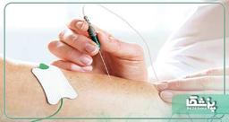 اقدامات قبل از انجام تست نوار عصب و عضله