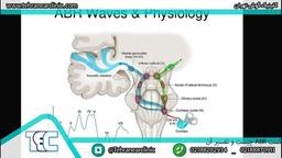 تست ABR چیست و در چه شرایطی تجویز می شود؟