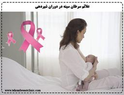 علائم سرطان سينه در دوران شيردهی