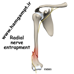 تاثیر فیزیوتراپی بر رویش مجدد عصب