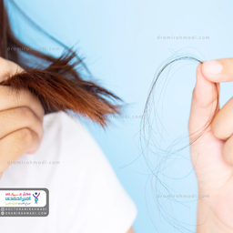 درباره علل و درمان ریزش مو بعد از جراحی لاغری بیشتر بدانید