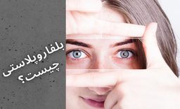 بلفاروپلاستی چیه و چطوری انجام می شه