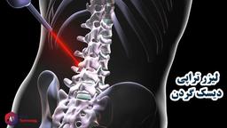 فیزیوتراپی دیسک گردن