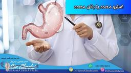 اسلیو معده یا بالون معده؟ مقایسه دو روش کاهش وزن